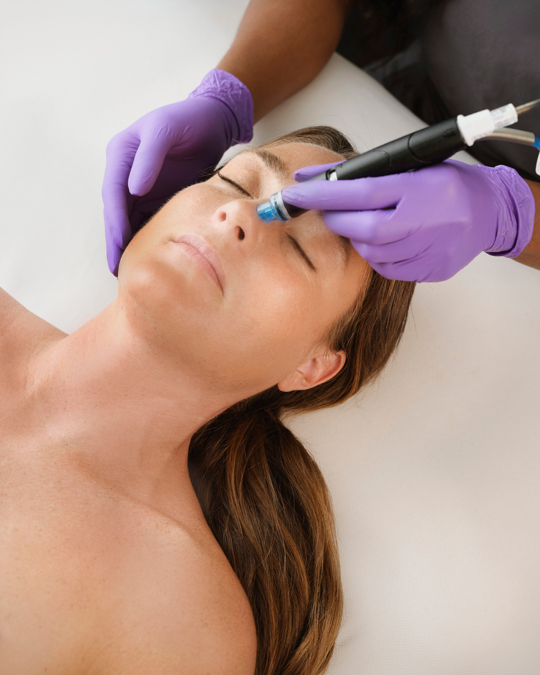 HydraFacial Treatment In Boston