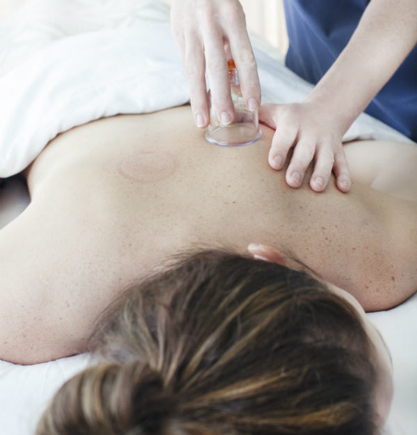 Woman receiving cupping treatment at Bella Sante Spa in Boston, Lexington and Wellesley MA