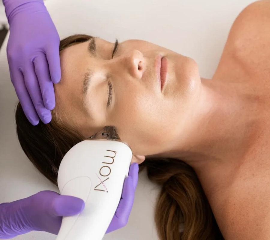 Guest receiving Moxi Laser treatment during the summer at Bella Sante Med Spa