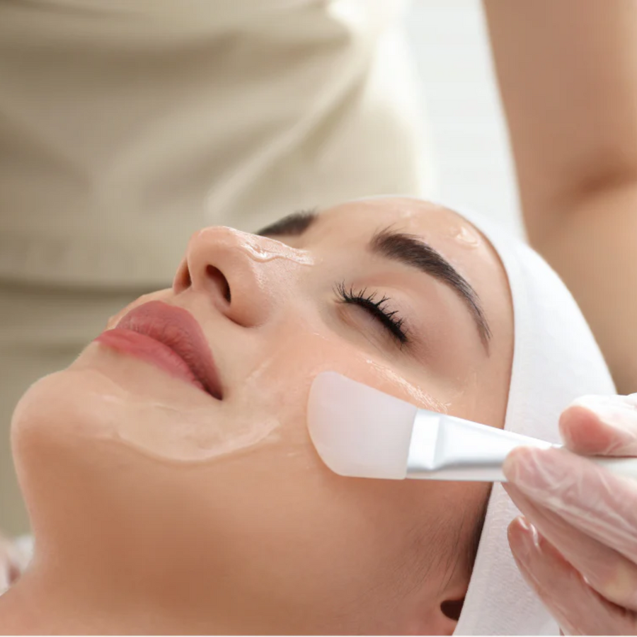 Chemical peel facial treatment for smoother, brighter skin