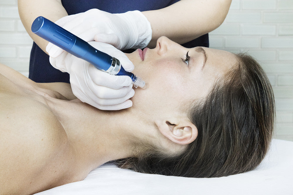 Microneedling at Bella Santé