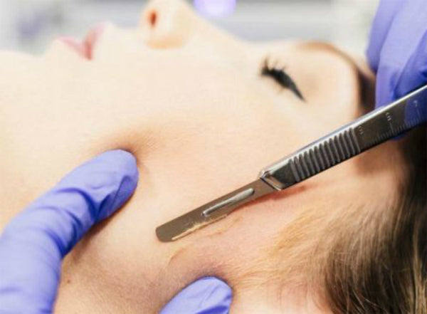 Woman receiving professional dermaplaning treatment at Bella Santé spa in Boston