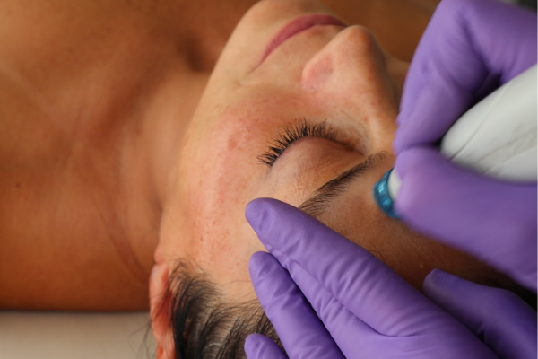 Top 5 Reasons To Try The HydraFacial