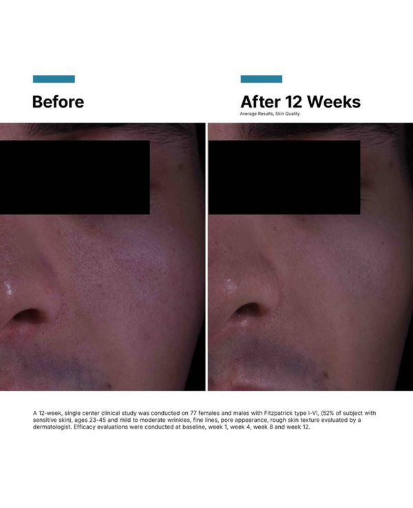 P-Tiox Anti-Wrinkle Cream