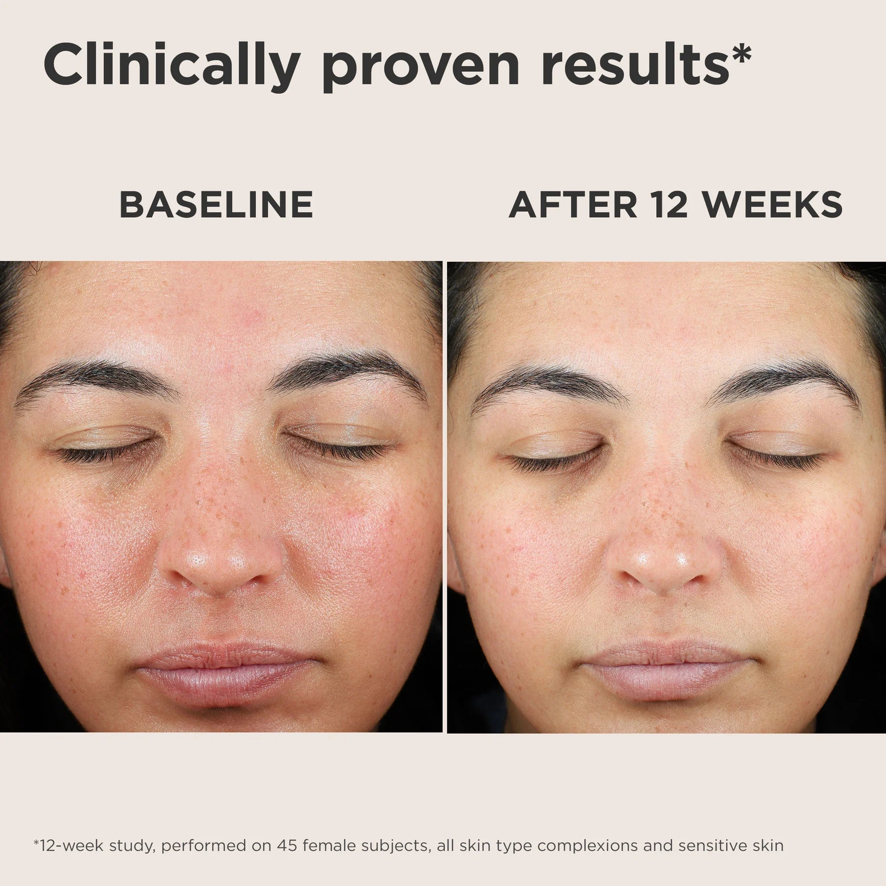 EltaMD UV Skin Recovery Color Correcting Green Tint Broad-Spectrum SPF 50