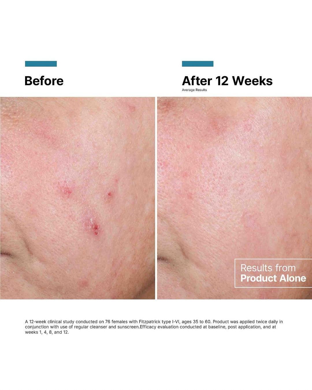 SkinCeuticals Advanced RGN-6 (1.0 oz) | Professional Retinol Night