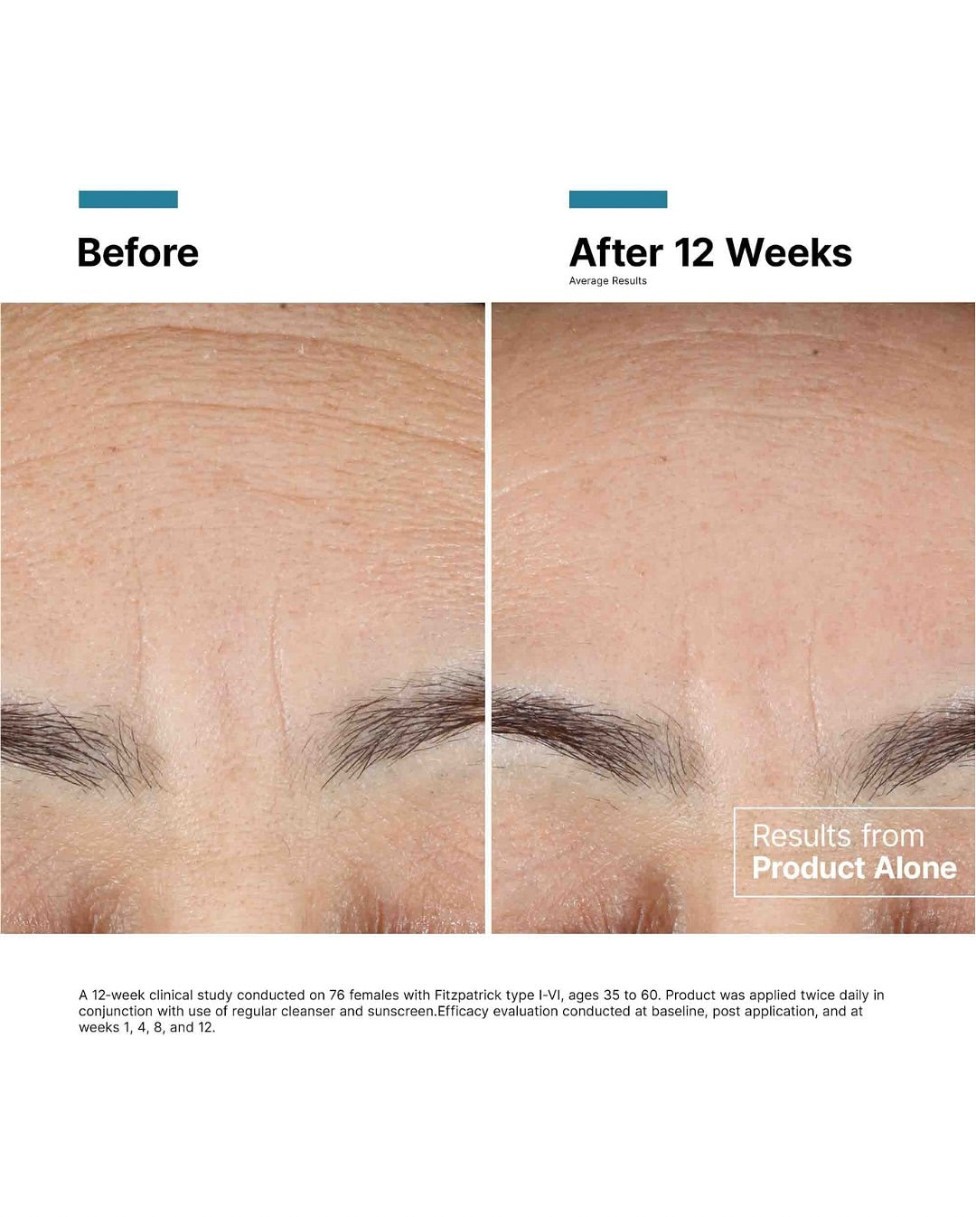 SkinCeuticals Advanced RGN-6 (1.0 oz) | Professional Retinol Night