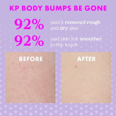 KP Body Bumps Be Gone Smoothing Exfoliating Body Scrub