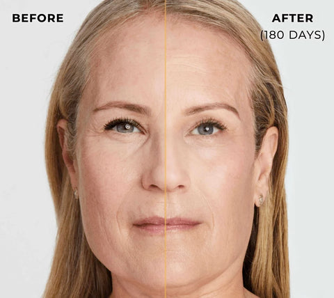 NEW Ultherapy Glow Facial